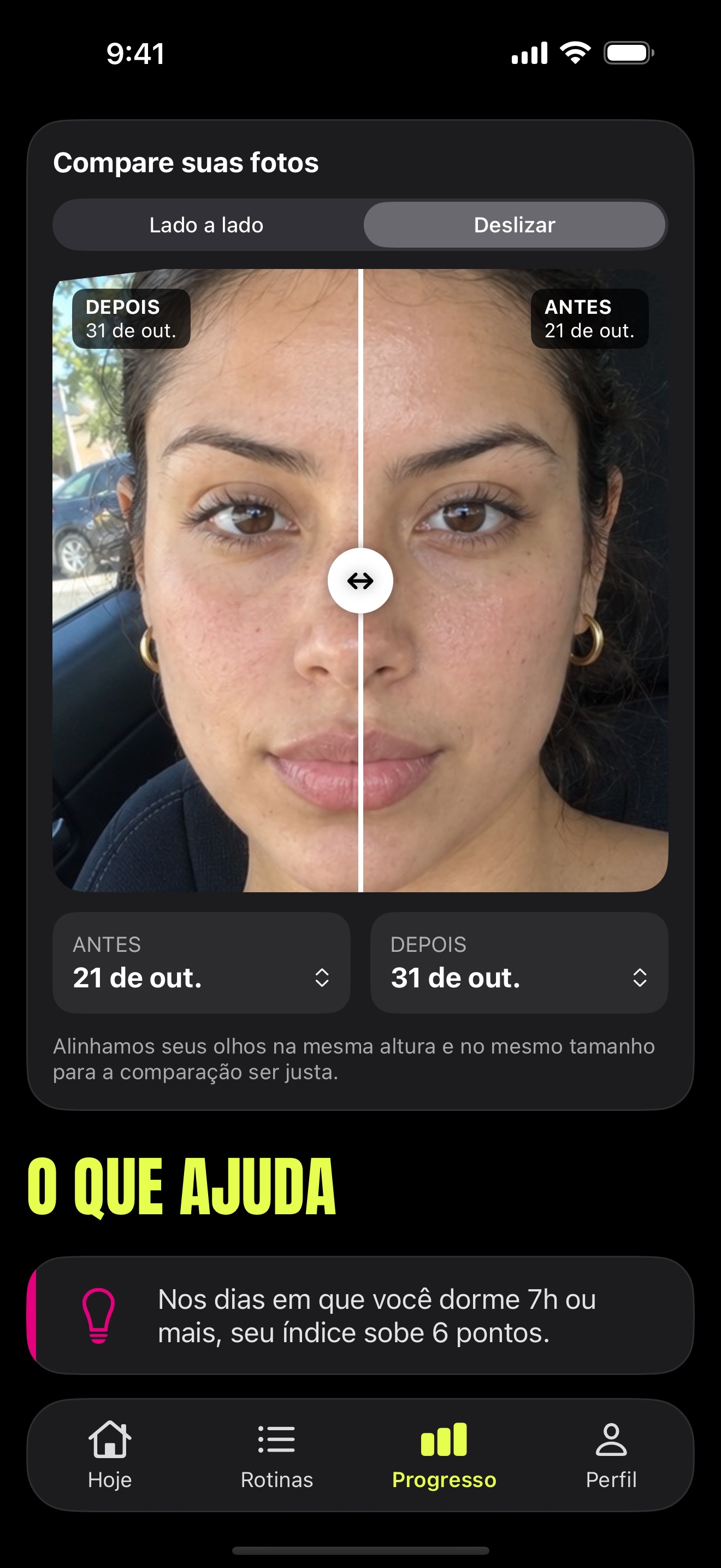 Tela Progresso: comparação de fotos antes e depois e o que ajuda, com base nos seus dados.