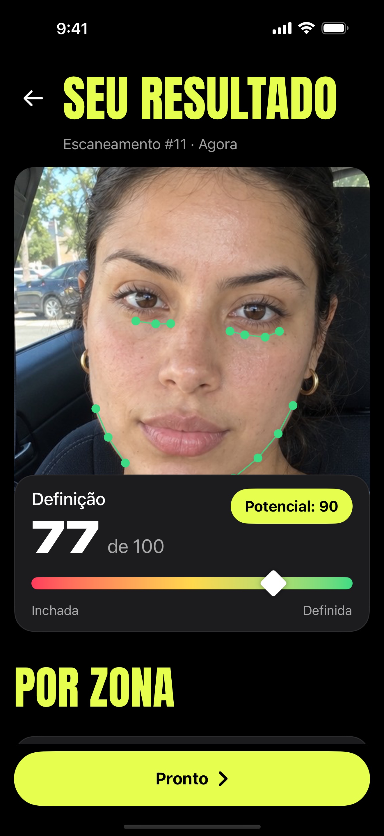 Tela Seu resultado do Friozin: definição 71 de 100, potencial 87, com pontos de referência nos olhos e na mandíbula.